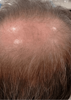 early start first image