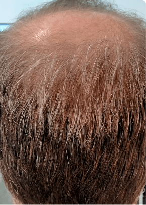 early start second image