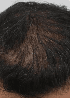 success stories hero after image