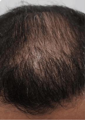 success stories hero before image