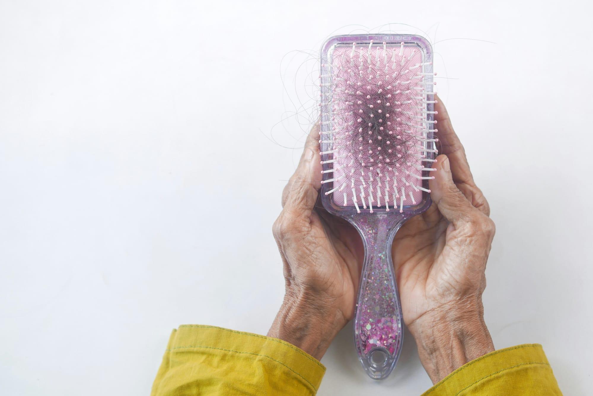 What Causes Hair Loss? The Science Behind Why It Happens and How to Stop It